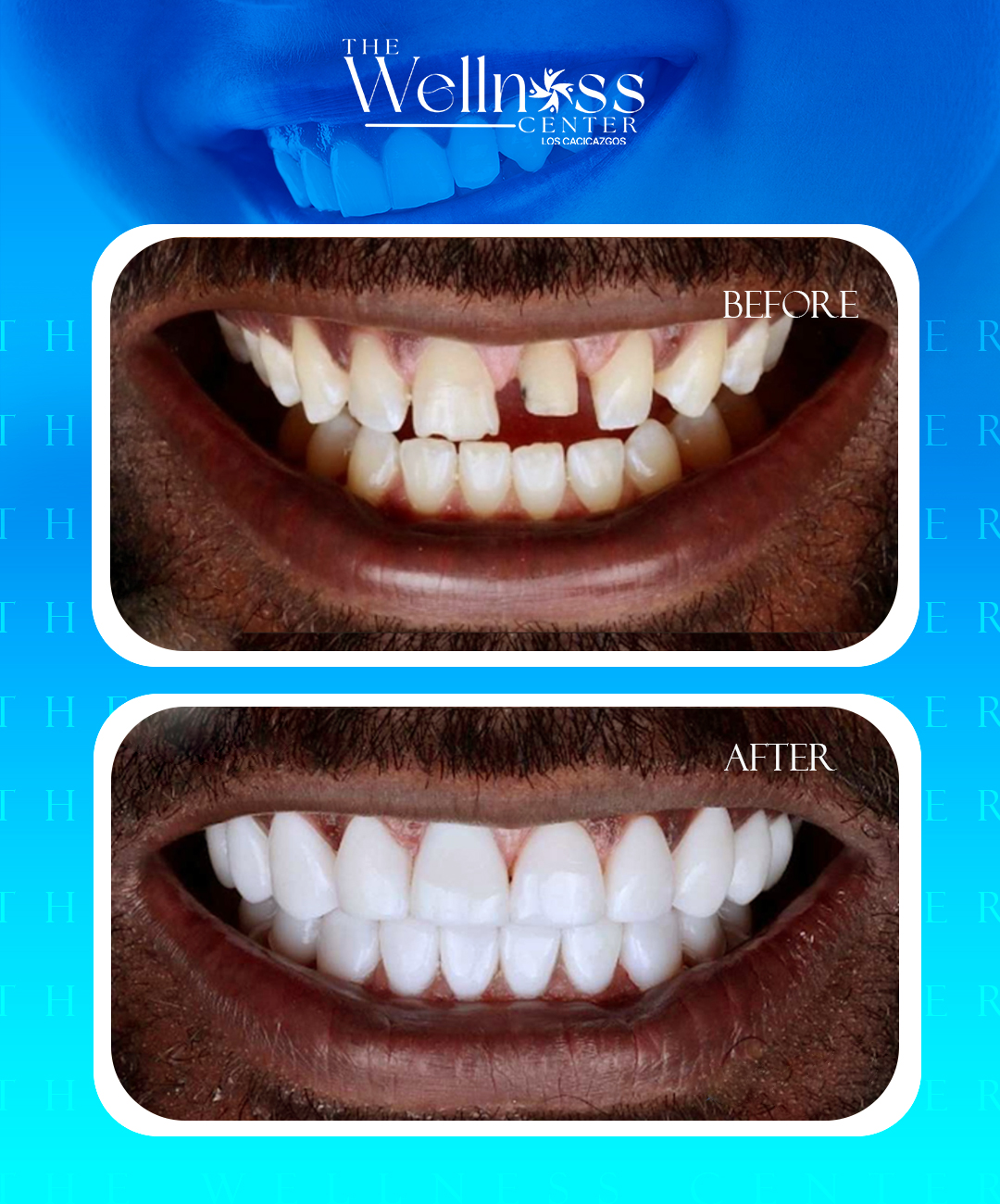 antes-y-despues-denta9l